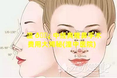 湟 🌿 中经典隆鼻手术费用大揭秘(湟中医院)